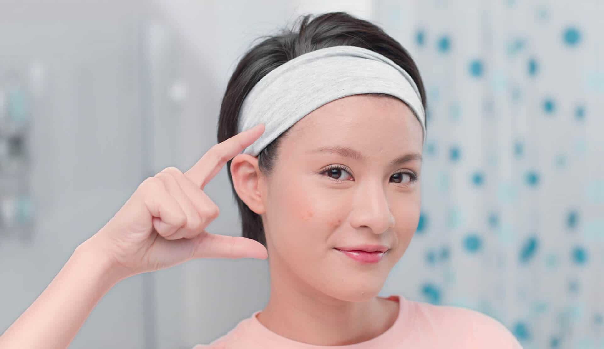 Acne Scarring ( Malay Article )